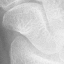 Scaphoid.bmp