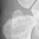 DistalUlna.bmp