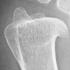 DistalUlna.bmp