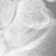 Scaphoid.bmp