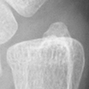 DistalUlna.bmp