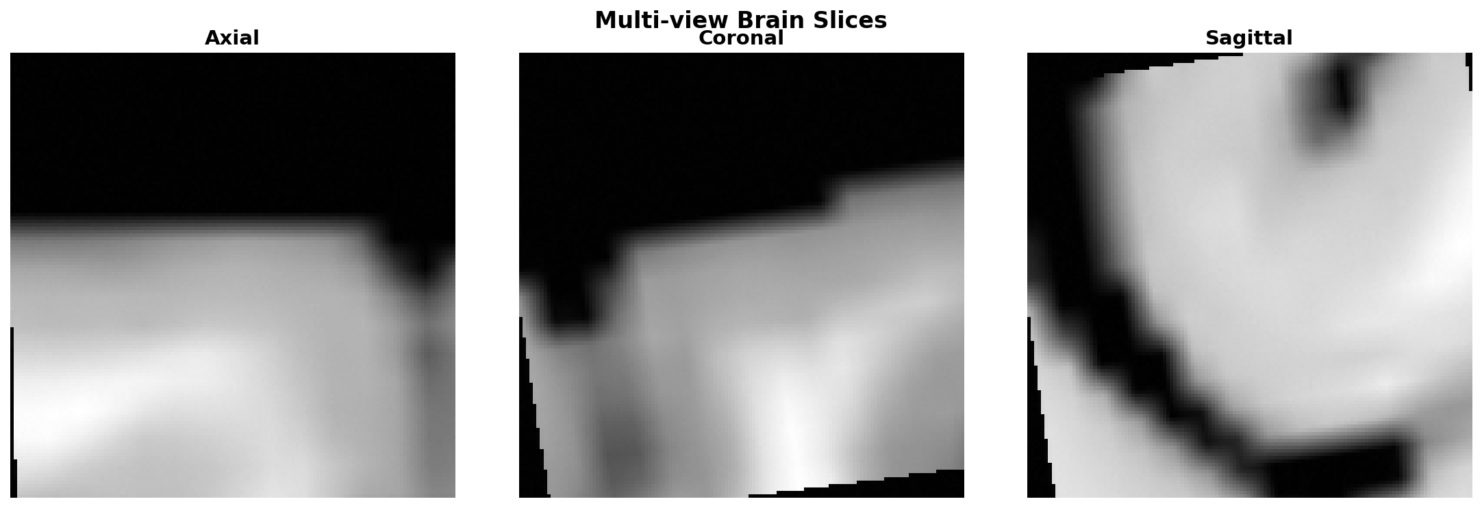Multiview Sample